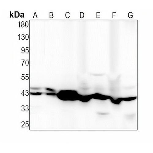 ARP2 Rabbit Monoclonal Antibody(C1445)