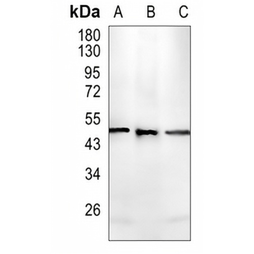 Cytochrome P450 4A11 Rabbit Monoclonal Antibody(C1446)