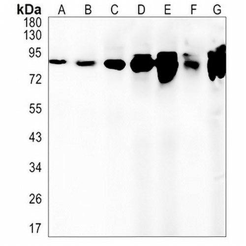 Aconitase 2 Rabbit Monoclonal Antibody(C1447)