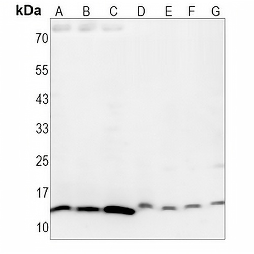 PEN-2 Rabbit Monoclonal Antibody(C1450)