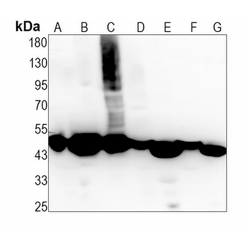 EEF1A1 Rabbit Monoclonal Antibody(C1452)