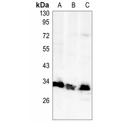 MBD3 Rabbit Monoclonal Antibody(C1455)
