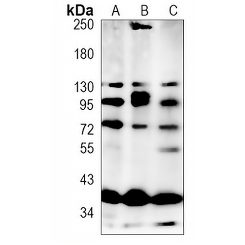 FOXP1 Rabbit Monoclonal Antibody(C1457)