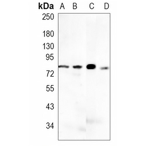 CD10  Rabbit Monoclonal Antibody(C1458)