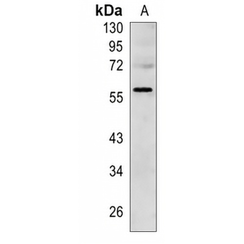 TDT  Rabbit Monoclonal Antibody(C1459)