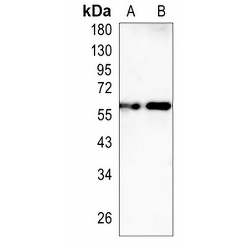 GRB7 Rabbit Monoclonal Antibody(C1460)