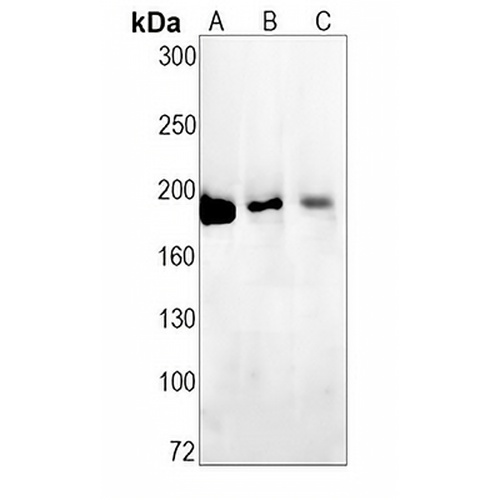 PB1 Rabbit Monoclonal Antibody(C1461)