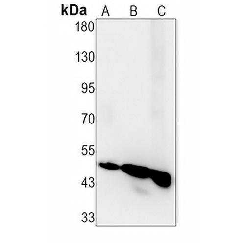FDFT1 Rabbit Monoclonal Antibody(C1462)