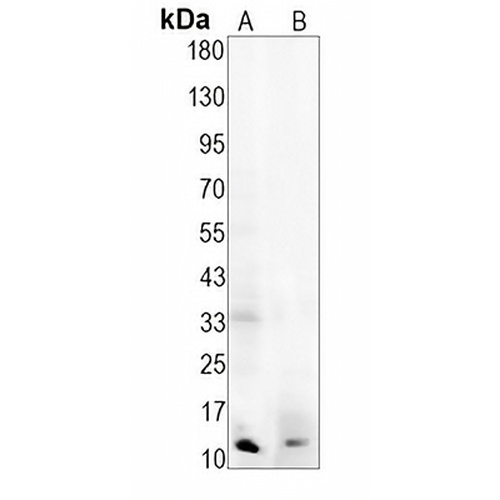 IL-8 Rabbit Monoclonal Antibody(C1464)