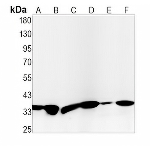 GNB2 Rabbit Monoclonal Antibody(C1467)