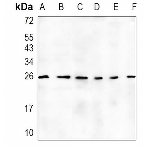 LYPLA1 Rabbit Monoclonal Antibody(C1468)