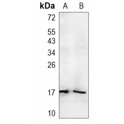 PIP Rabbit Monoclonal Antibody(C1469)