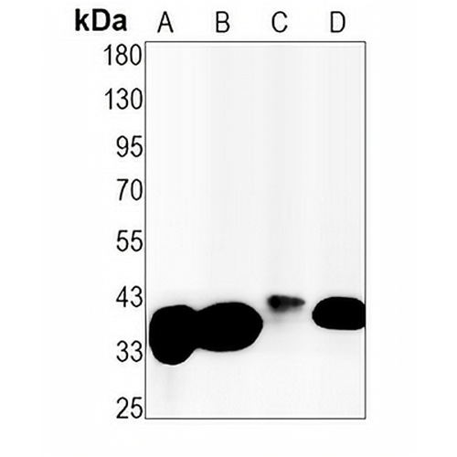FBP1 Rabbit Monoclonal Antibody(C1471)