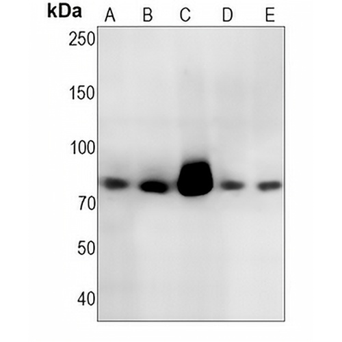 Lactoferrin Rabbit Monoclonal Antibody(C1473)