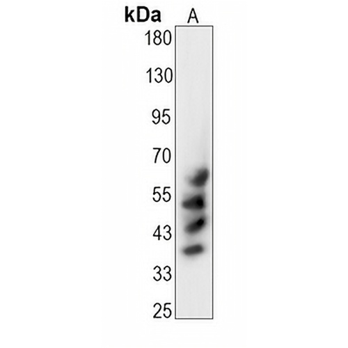 CD147  Rabbit Monoclonal Antibody(C1474)