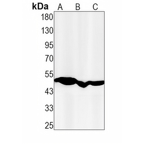 ABAT Rabbit Monoclonal Antibody(C1475)