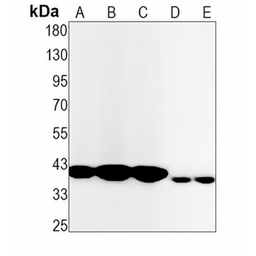 NUDC Rabbit Monoclonal Antibody(C1476)
