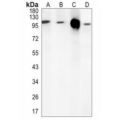 KAP3 Rabbit Monoclonal Antibody(C1478)
