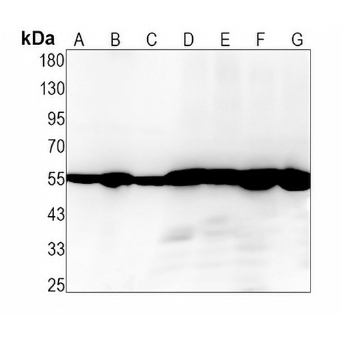 DLD Rabbit Monoclonal Antibody(C1479)