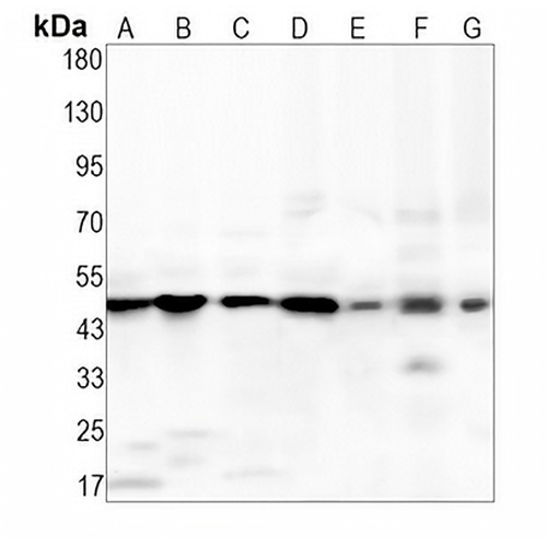 IL-11RA Rabbit Monoclonal Antibody(C1482)