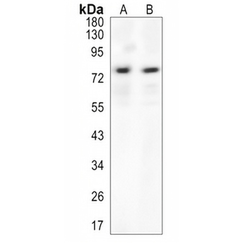 Abi-2 Rabbit Monoclonal Antibody(C1483)
