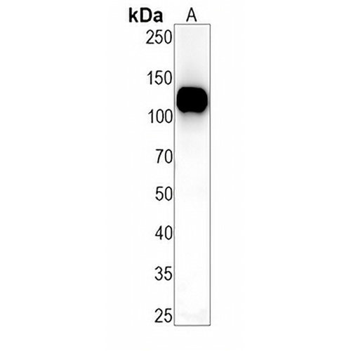 c-CBL (Phospho-S669) Rabbit Monoclonal Antibody(C1486)