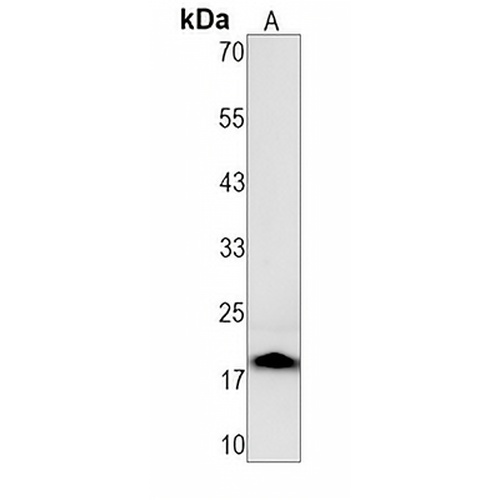 PTPS (Phospho-S19) Rabbit Monoclonal Antibody(C1487)