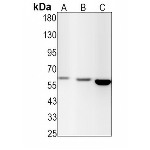 c-Myc (Phospho-T58+S62) Rabbit Monoclonal Antibody(C1489)
