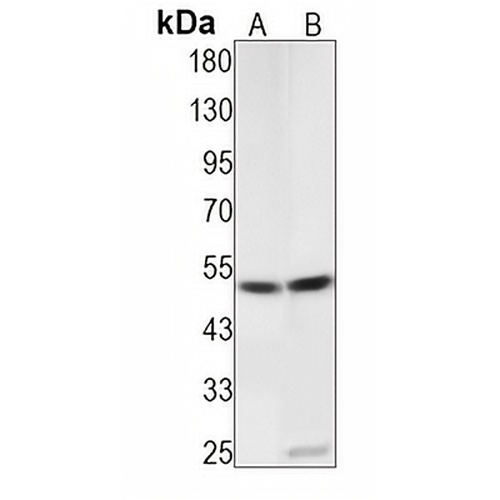 PRKAR2A (Phospho-S99) Rabbit Monoclonal Antibody(C1490)
