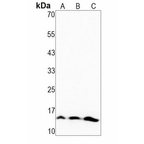 Histone H3 (Phospho-S31) Rabbit Monoclonal Antibody(C1493)