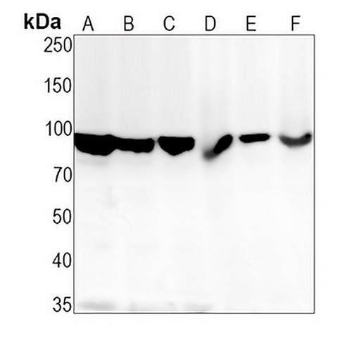 FOXO3 (Phospho-S253) Rabbit Monoclonal Antibody(C1498)