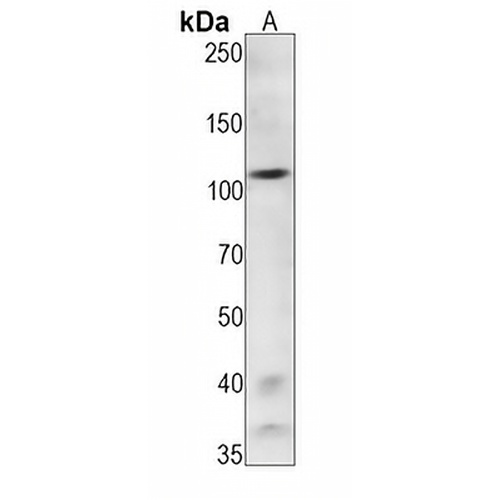 IRE1 (Phospho-S724) Rabbit Monoclonal Antibody(C1501)