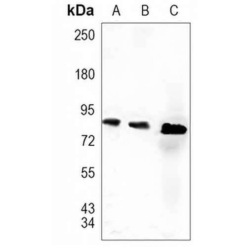 MSK1 (Phospho-S376) Rabbit Monoclonal Antibody(C1503)