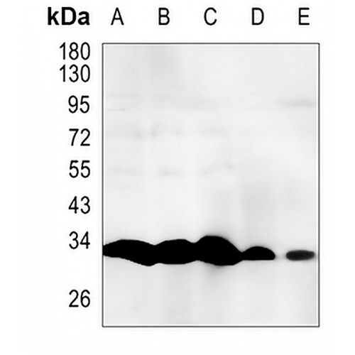 RPA2 (Phospho-T21) Rabbit Monoclonal Antibody(C1504)