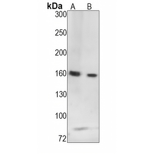 SMC1A (Phospho-S957) Rabbit Monoclonal Antibody(C1505)