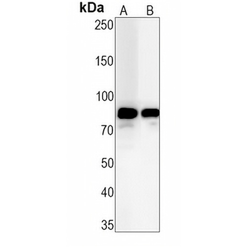 HSL (Phospho-S853) Rabbit Monoclonal Antibody(C1506)