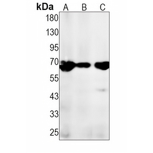 PKC zeta (Phospho-T560) Rabbit Monoclonal Antibody(C1507)