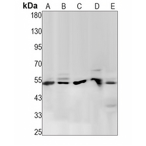 PTEN (Phospho-S380) Rabbit Monoclonal Antibody(C1508)