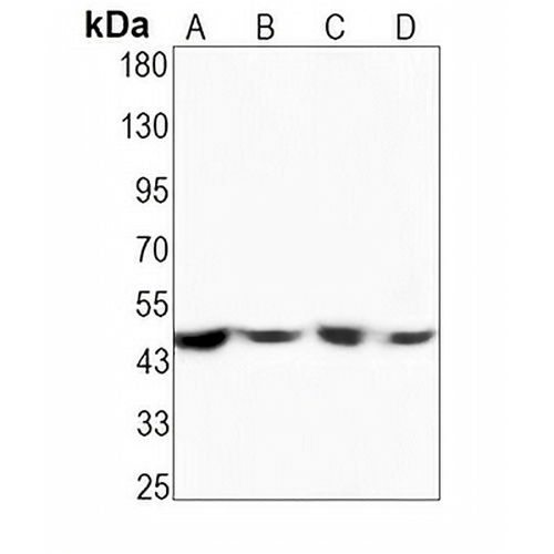 MKK1 (Phospho-S298) Rabbit Monoclonal Antibody(C1509)