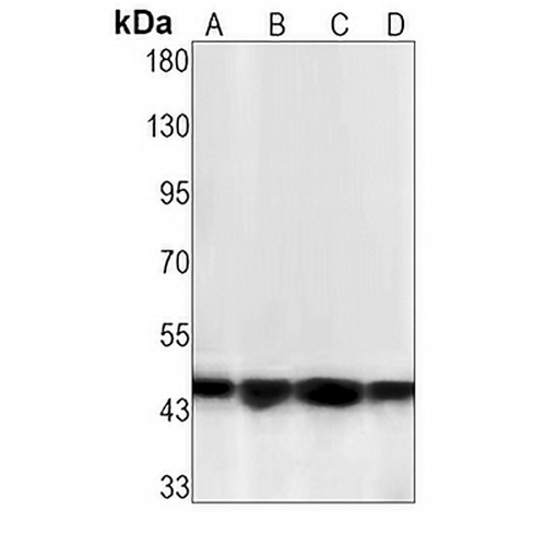 MKK1 (Phospho-T292) Rabbit Monoclonal Antibody(C1510)