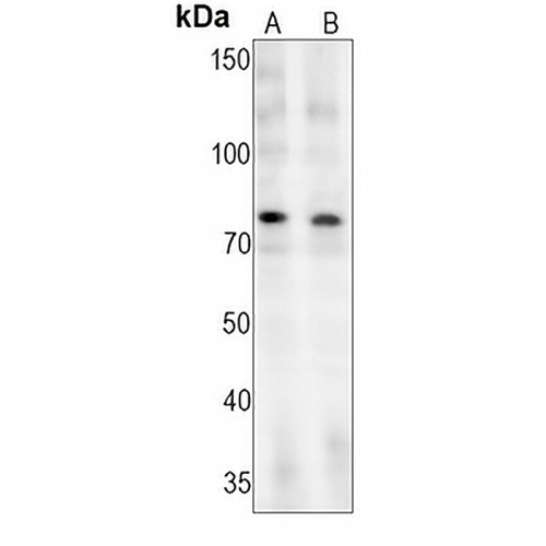 c-RAF (Phospho-S621) Rabbit Monoclonal Antibody(C1513)