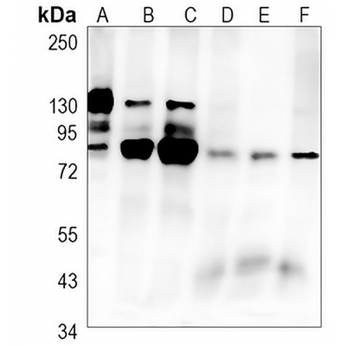 PKC alpha (Phospho-T638) Rabbit Monoclonal Antibody(C1518)