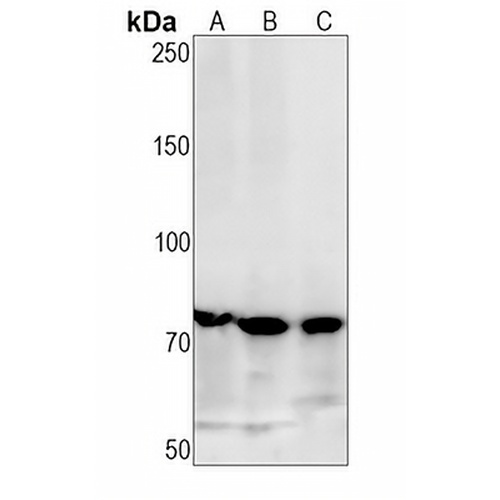 PAK4/5/6 (Phospho-S474/560/602) Rabbit Monoclonal Antibody(C1520)