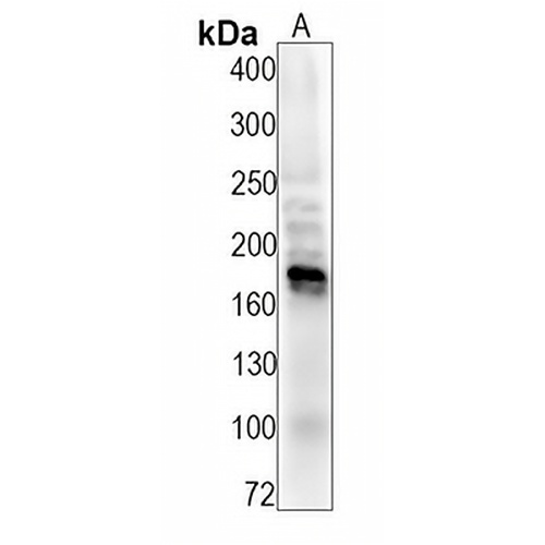 HER2 (Phospho-Y1221+Y1222) Rabbit Monoclonal Antibody(C1522)