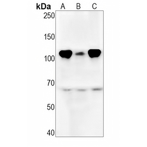 RB1 (Phospho-S780) Rabbit Monoclonal Antibody(C1523)