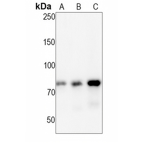 TAK1 (Phospho-S439) Rabbit Monoclonal Antibody(C1524)