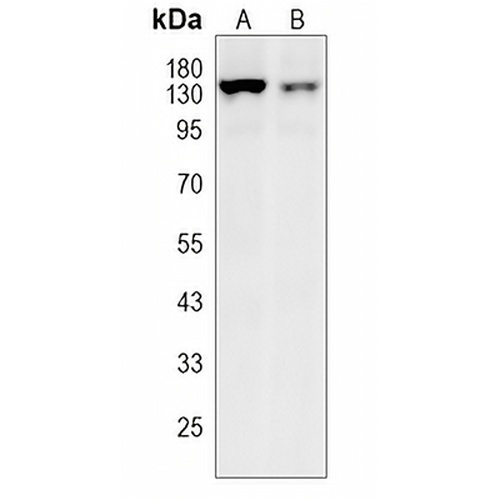 ULK1 (Phospho-S556) Rabbit Monoclonal Antibody(C1526)