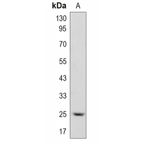 Cathepsin S Rabbit Monoclonal Antibody(C1527)