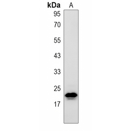 CBFB Rabbit Monoclonal Antibody(C1528)