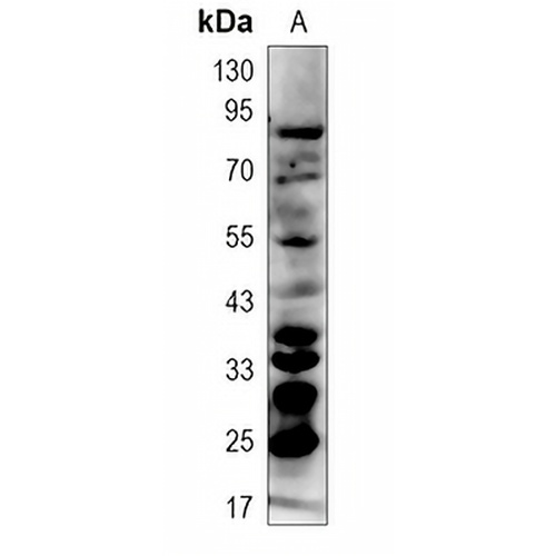 Ubiquitin (Linkage specific-K63) Rabbit Monoclonal Antibody(C1529)